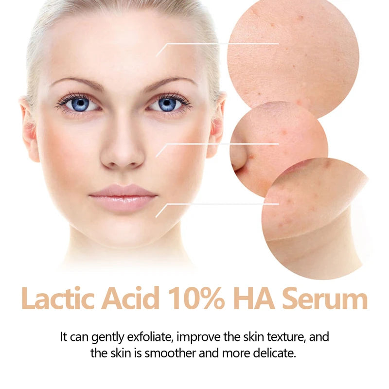 Lactic Acid Face Serum for Exfoliating Hydrating Brightening & Anti-Aging - All Skin Types