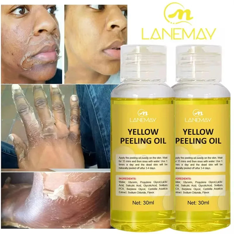 Strong Yellow Peeling Oil for Dark Skin Lightening & Exfoliation - Body & Hands