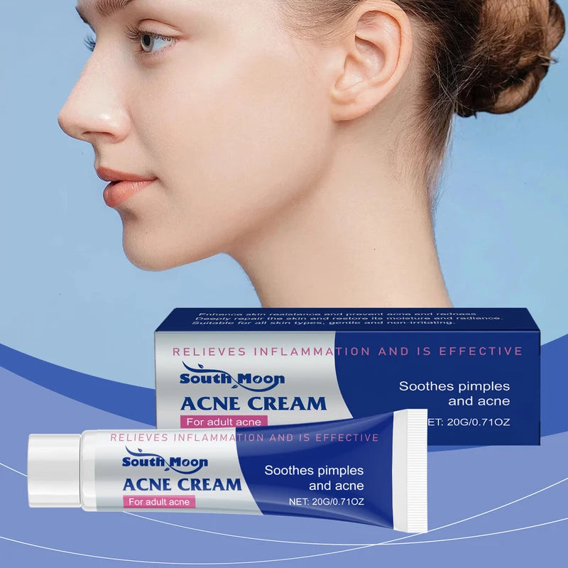 Anti Acne Cream Oil Control Pimple Spot Treatment for All Skin Types - 20g