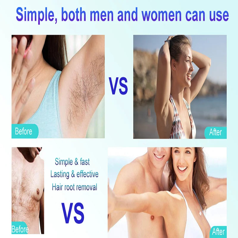Hard Wax Beans for Hair Removal - 4 Pack 50g Bikini & Body Depilation