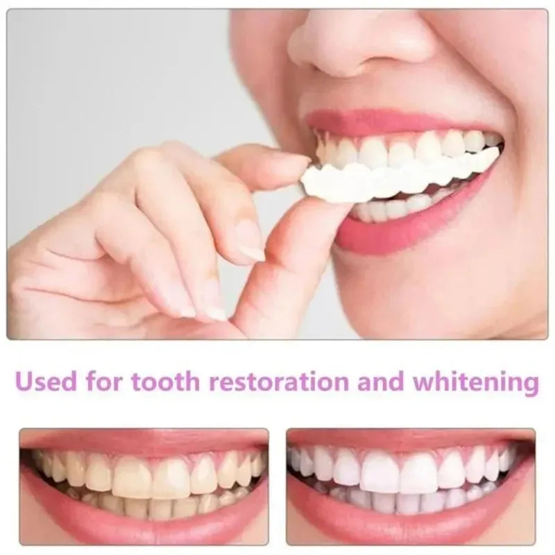 Unisex Snap-On Teeth Veneers - Instant Smile Makeover Cosmetic Teeth