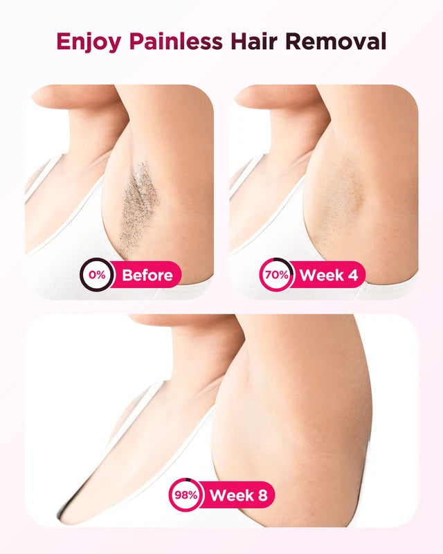 Painless IPL Hair Removal Device for Men & Women - Permanent Laser Hair Reducer