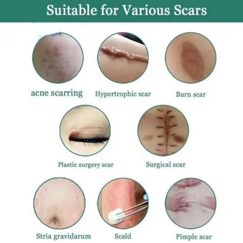 Fade Scar Repair Gel for Skin Healing Postpartum & Surgery - Smooths Skin