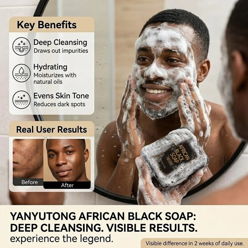 Moisturizing African Black Soap with Shea Butter Oil for Deep Cleansing & Skin Hydration