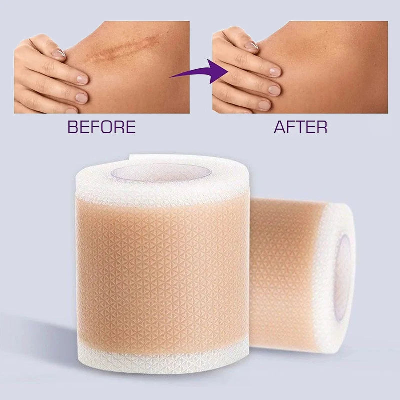 Silicone Scar Sheets Self-Adhesive Reusable Skin Care Tape - Multiple Colors