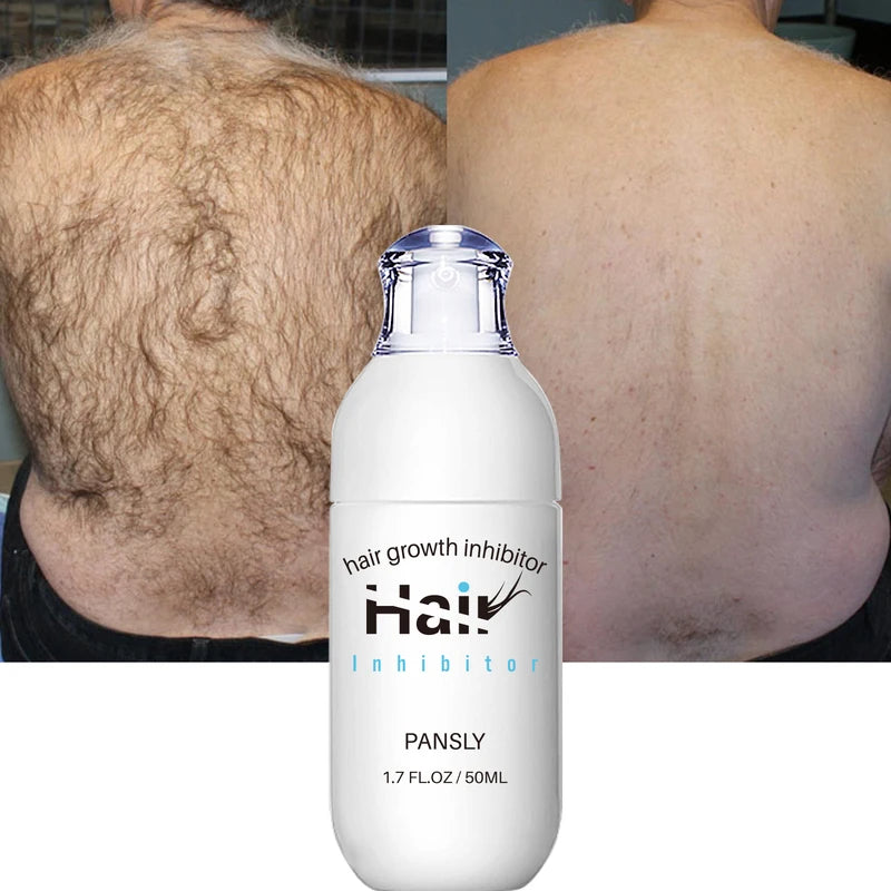 Hair Growth Inhibitor Spray - Painless Hair Removal & Skin Nourishment - 100ML