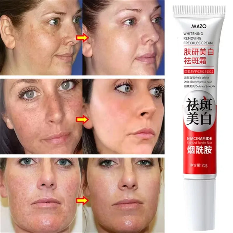 Brightening Skin Whitening Cream for Dark Spots & Melasma - All Variants