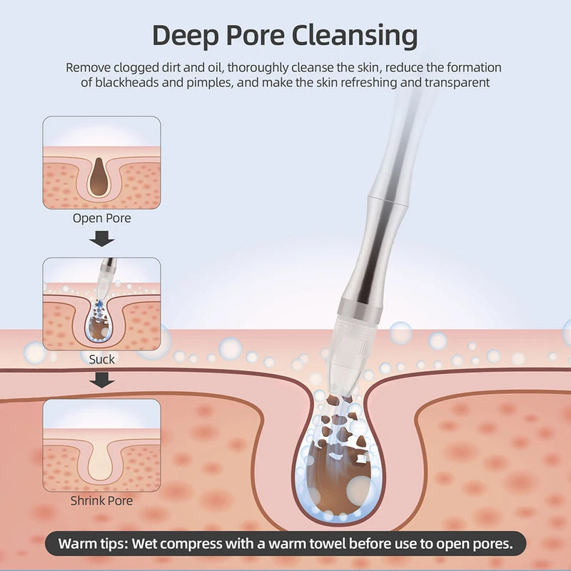 Deep Cleansing Facial Peeling Device for Skin Care & Pore Refinement