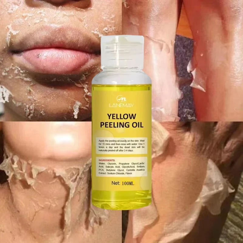Yellow Peeling Oil for Skin Lightening and Exfoliation - Body & Face
