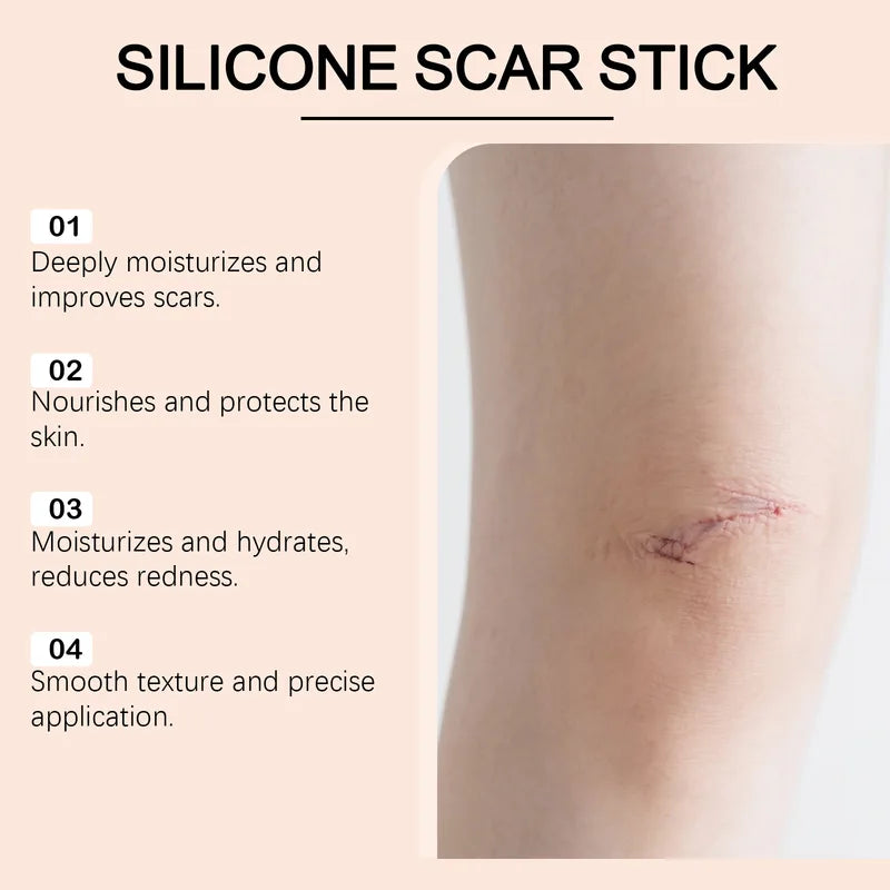 Silicone Scar Stick for Acne & Skin Repair - Redness & Blemish Support