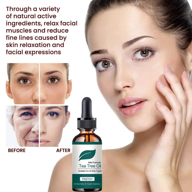 Gentle Tea Tree Oil for All Skin Types - Plant Extract Skincare, 15-50ml Variants