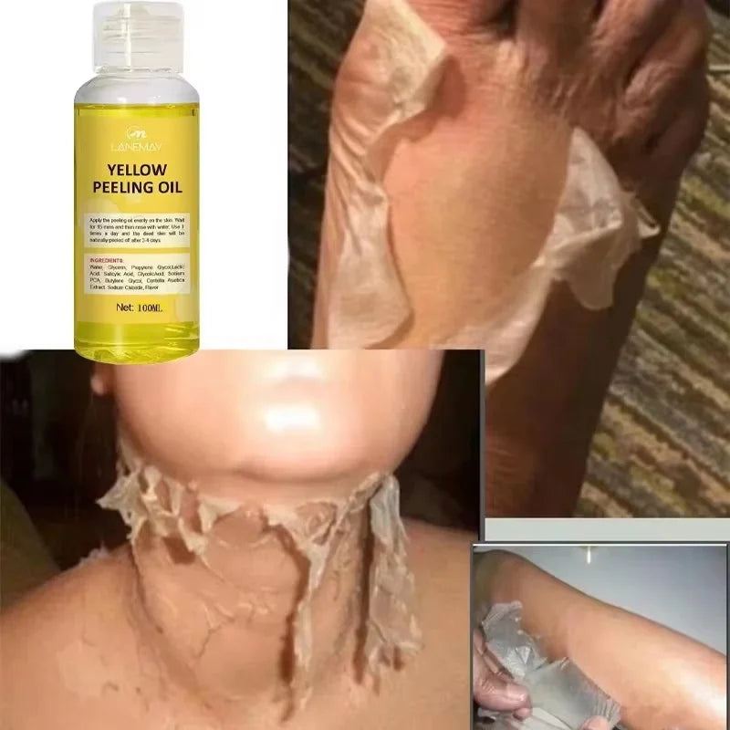 Strong Yellow Peeling Oil for Skin Brightening & Exfoliation - Body & Hands