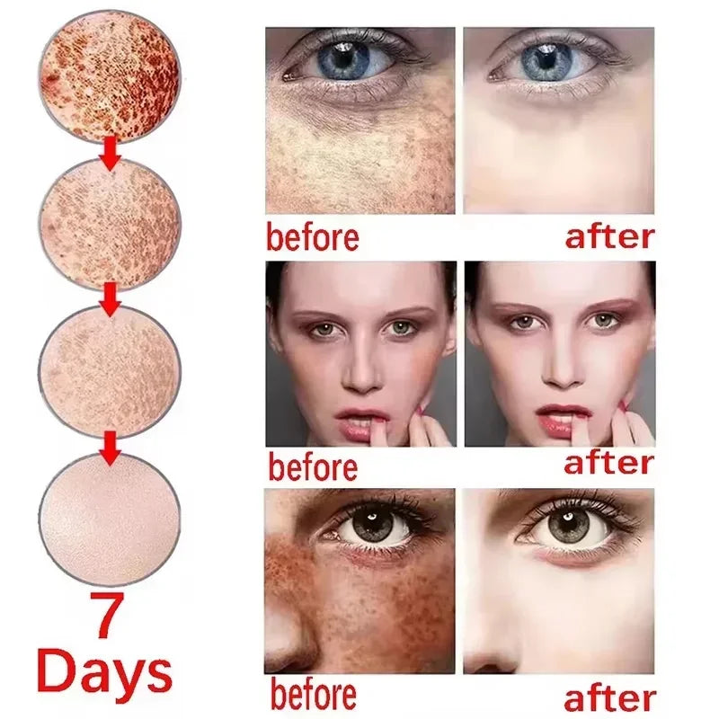 Whitening Face Cream for Dark Spots & Melasma - Brightening & Anti-Aging Skin Care