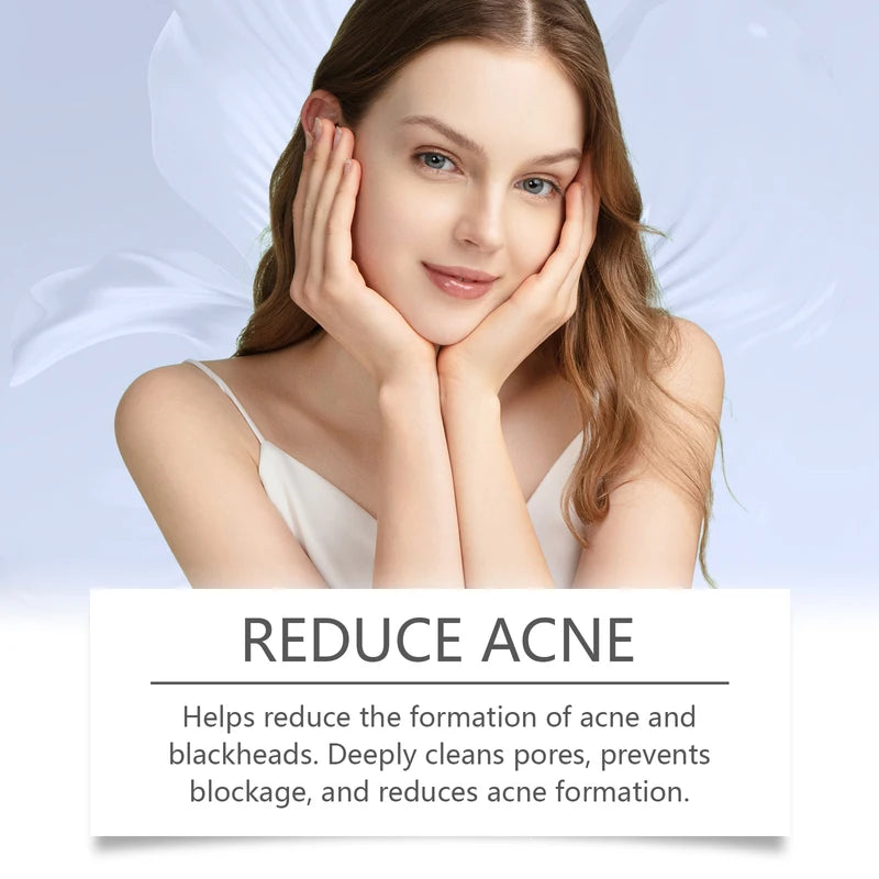 Anti Acne Cream Oil Control Pimple Spot Treatment for All Skin Types - 20g