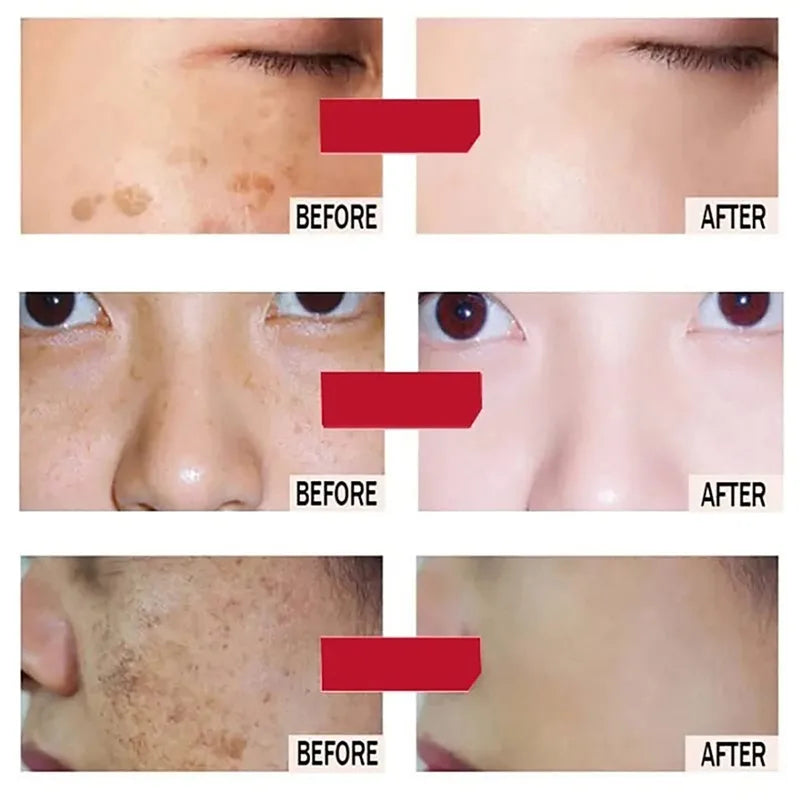 Whitening Face Serum for Anti-Aging & Dark Spots - Hydrating & Brightening