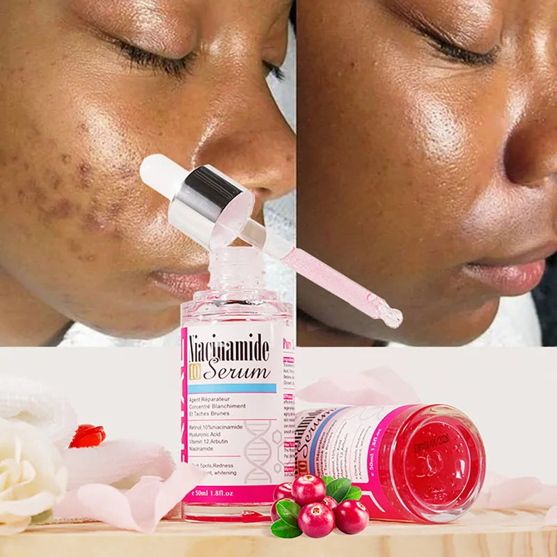 Nicotinamide Whitening Serum with Hyaluronic Acid for Face & Body - Anti-Aging, Brightening, Hydrating, Freckles & Spot Reduction