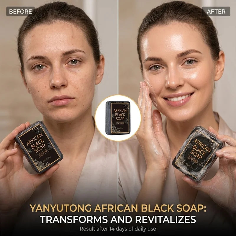 Moisturizing African Black Soap with Shea Butter Oil for Deep Cleansing & Skin Hydration