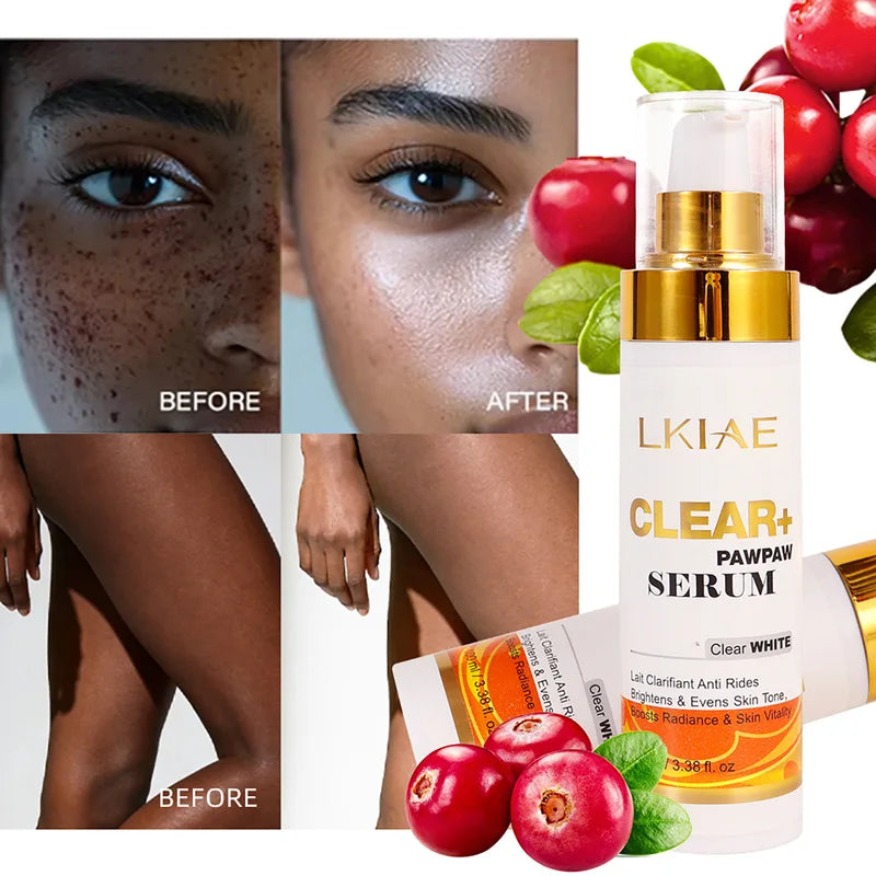 Papaya Whitening Skincare Set for Dark Spots & Dull Skin - Moisturizing & Brightening