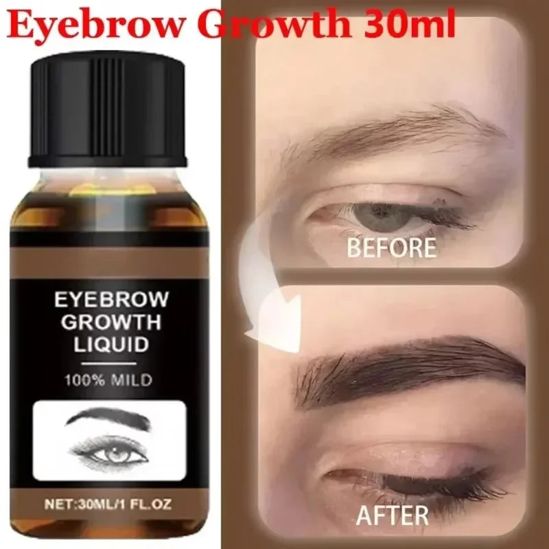 Eyebrow & Eyelash Growth Serum - Hair Loss Prevention & Fuller, Thicker Lengthening 30ml