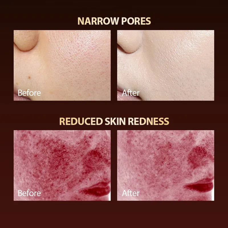 7 Colors LED Face Mask with Silicone Gel for Skin Rejuvenation & Oil Control