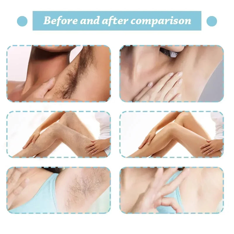 Permanent Hair Removal Spray - Pain-Free, Long-Lasting Results, Gentle on Skin