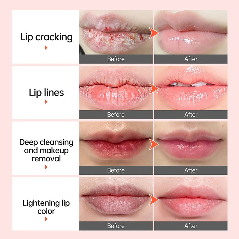 Lip Mask Bubble Exfoliating Oil - Lightening, Moisturizing & Brightening