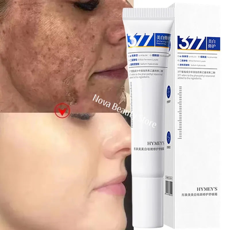Whitening Spot-Removing Face Cream for Brightening & Dark Spots - Multiple Colors