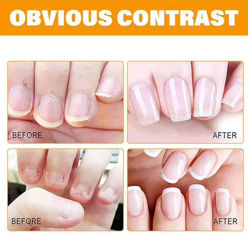 Nail Cuticle Oil for Moisturizing and Repairing Dry, Fragile Nails - Quick Drying, All Colors