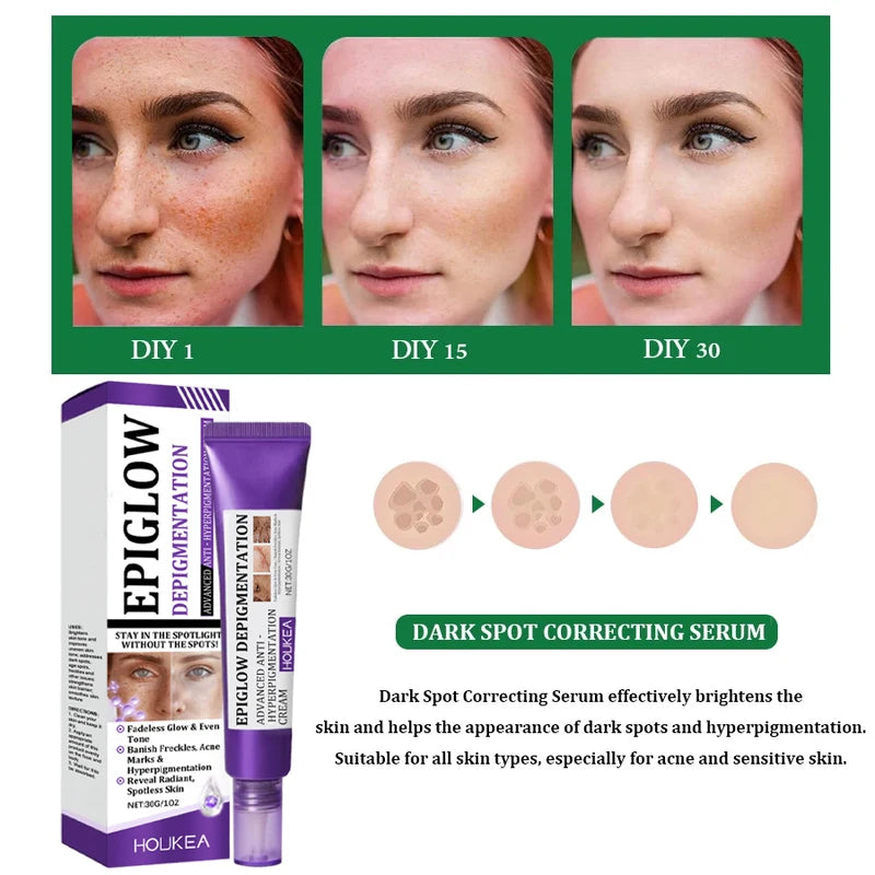 Freckle Whitening Cream for Dark Spots Melasma Skin Brightening & Hydration