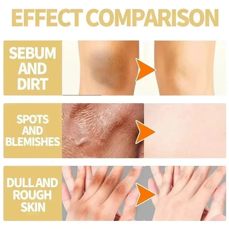 Yellow Peeling Oil for Skin Lightening and Exfoliation - Body & Face