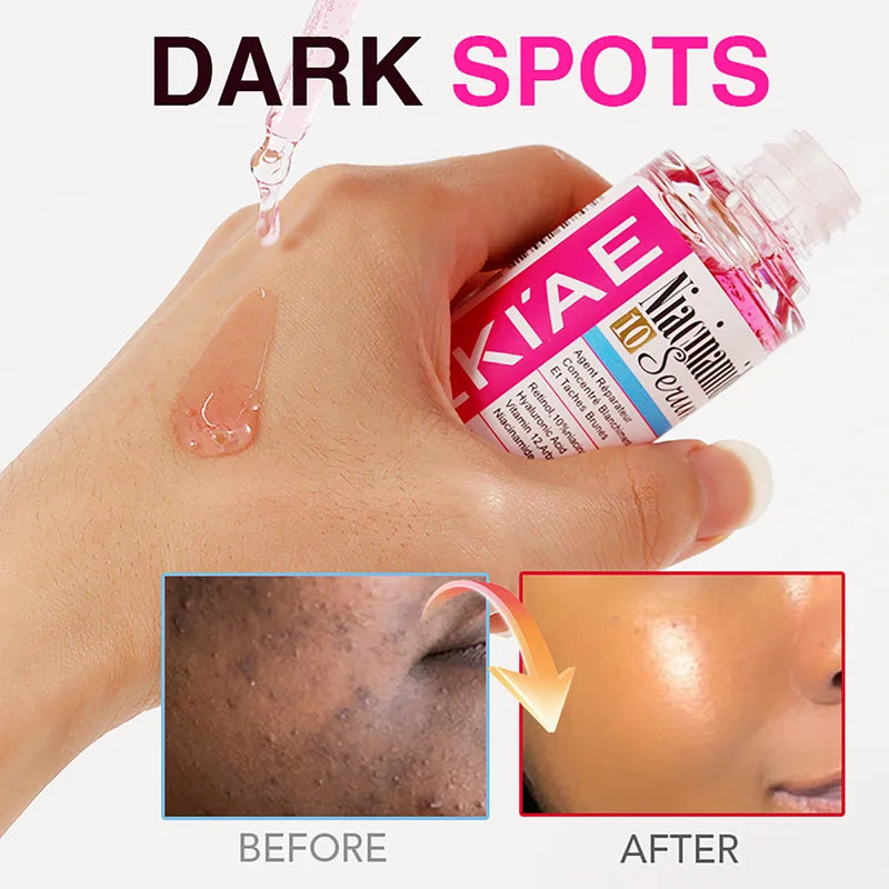 Nicotinamide Whitening Serum with Hyaluronic Acid for Face & Body - Anti-Aging, Brightening, Hydrating, Freckles & Spot Reduction