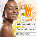 Lightening Body Cream with Vitamin C & Hyaluronic Acid - Hydrating Skin Tone Corrector