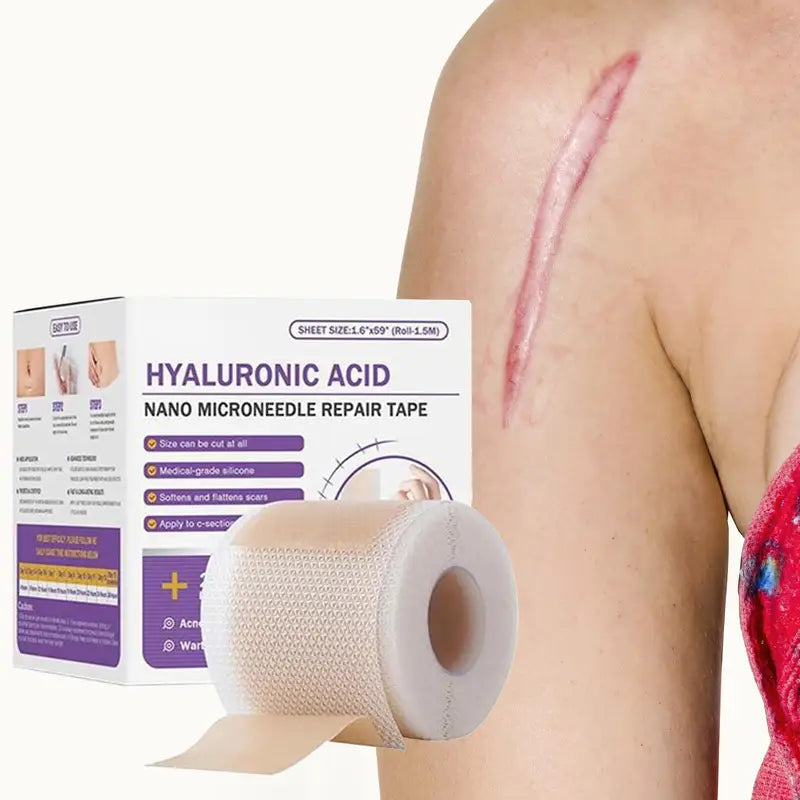 Silicone Scar Removal Patch - Gentle, Breathable Skin Repair Tape for Keloid, Burn & Trauma Scars