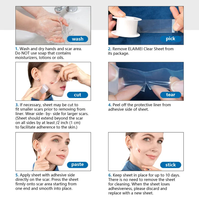 Invisible Silicone Scar Sheets - Self-Adhesive Skin Care Tape 150cm