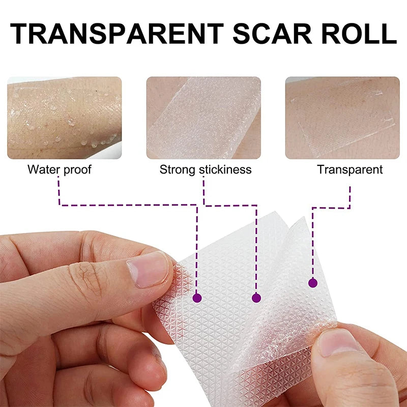 Silicone Scar Removal Patches - 4 Pack 15cm Wound & Burn Scar Tape