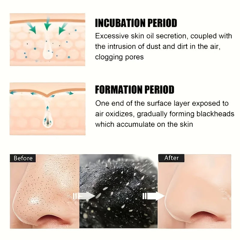 Alcohol-Free Nose Cleaning Strips - Deep Pore Cleansing & Oil Removal