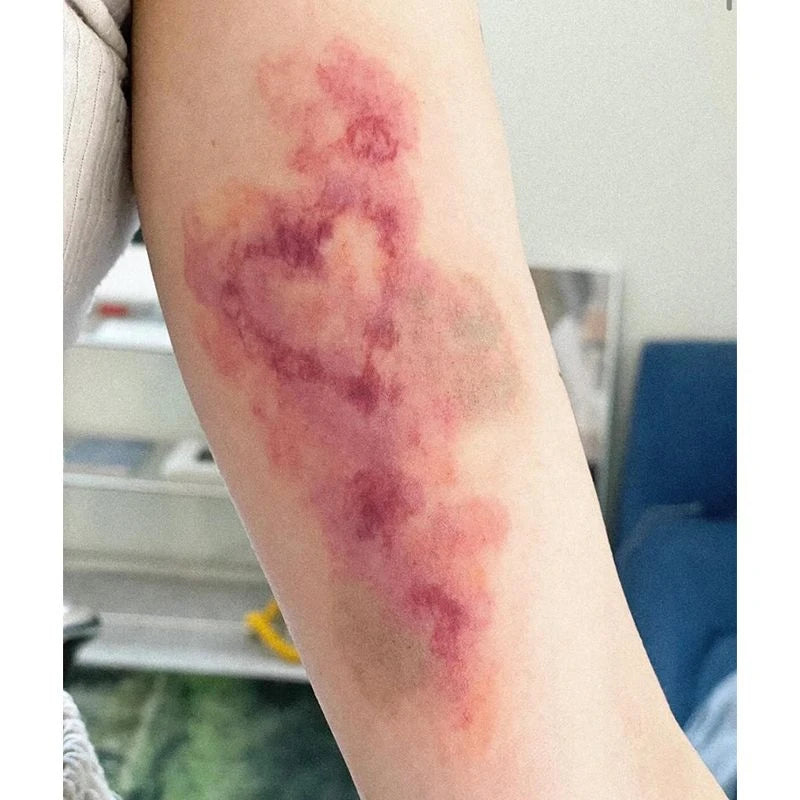 Heart Bruise Fake Tattoo for Women and Men Waterproof Arm Art Scar Blood Stasis Temporary Tattoo Set