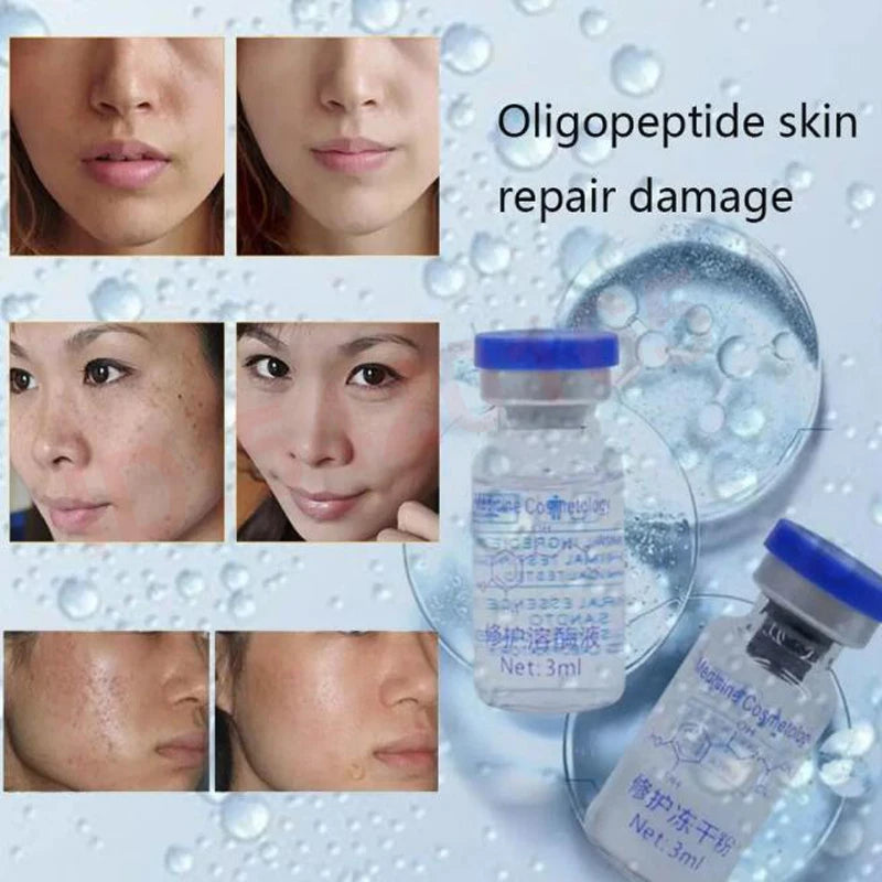 Skin Repair Oligopeptide Powder Ampoule for Acne Scars Sensitive Skin Booster