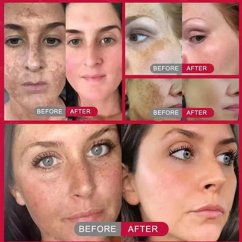 Whitening Face Cream for Dark Spots & Melasma - Brightening & Anti-Aging Skin Care
