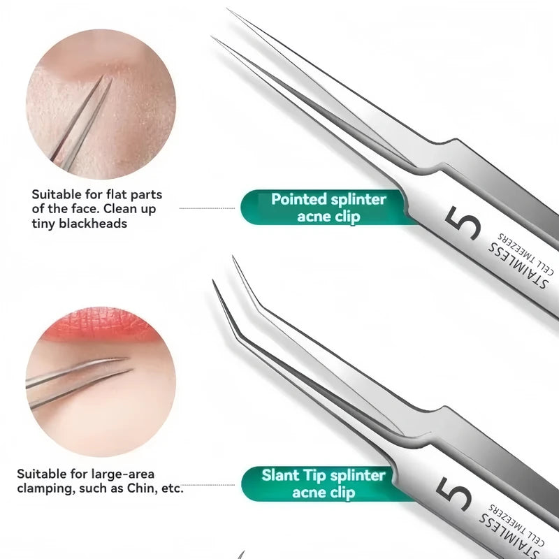 8-Piece Stainless Steel Acne Needle Tool Set for Blackhead Removal & Home Skin Care