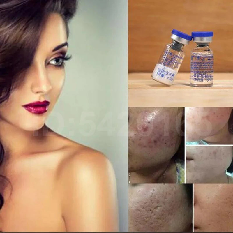 Skin Repair Oligopeptide Powder Ampoule for Acne Scars Sensitive Skin Booster