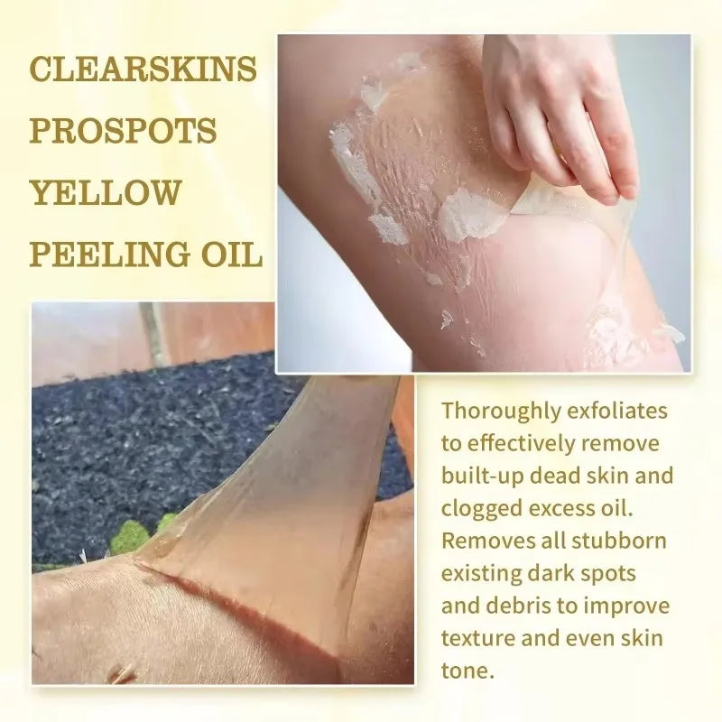 Strong Yellow Peeling Oil for Dark Skin Lightening & Exfoliation - Body & Hands