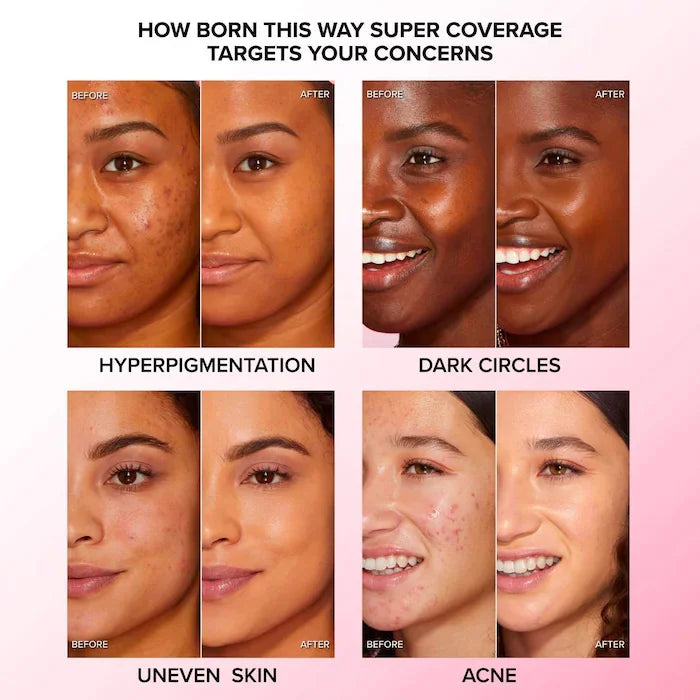 Multi-Use Concealer with Hyaluronic Acid - Flawless Shades for Face & Under Eye