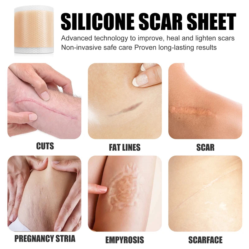 Reusable Silicone Scar Sheets for Surgical & Hypertrophic Scars - Medical Grade, Custom Fit