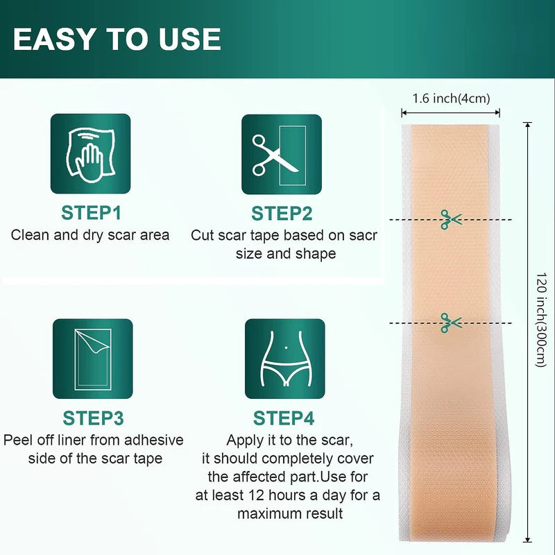 Silicone Scar Treatment Sheets Roll Reusable Strips for Keloid & Burn Scars