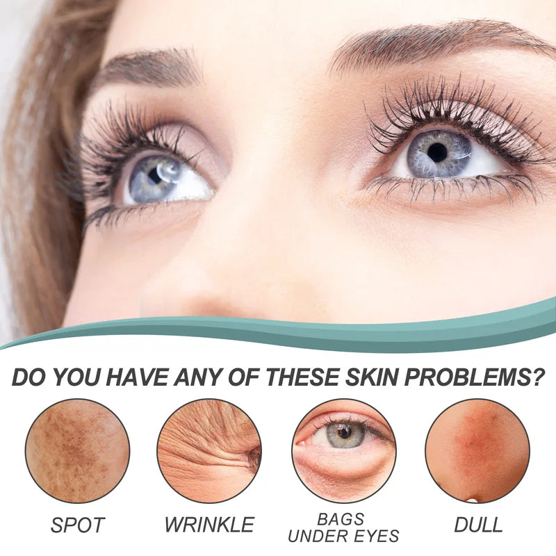 Dark Spot Remover Face Cream with Hydration & Brightening - 30g