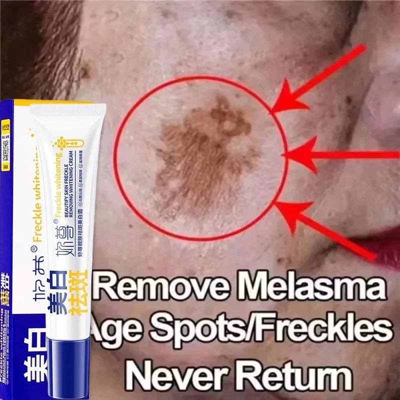 Whitening Face Cream for Dark Spots & Melasma - Brightening Skin Fast