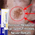 Whitening Face Cream for Dark Spots & Melasma - Brightening Skin Fast