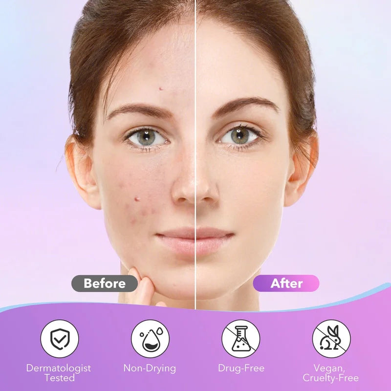 Star-Shaped Multi-Color Acne Patches - Gentle, Non-Irritating Cover for Blemishes