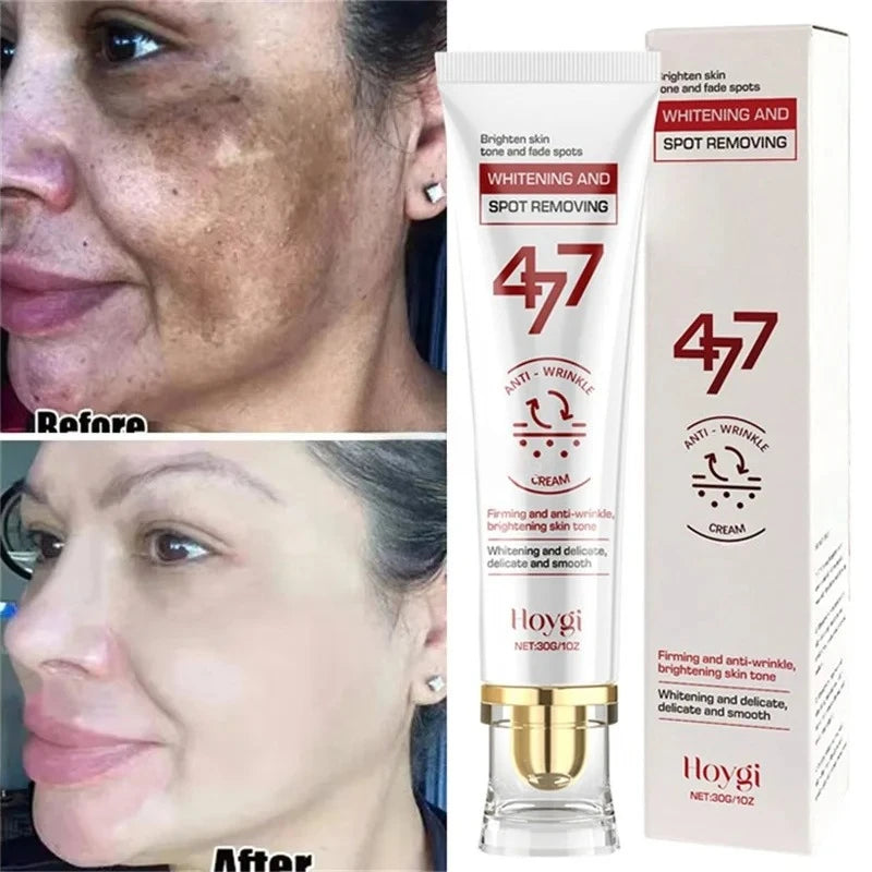 Spot-Removing Brightening Face Cream for Melasma Dark Spots - Multiple Colors